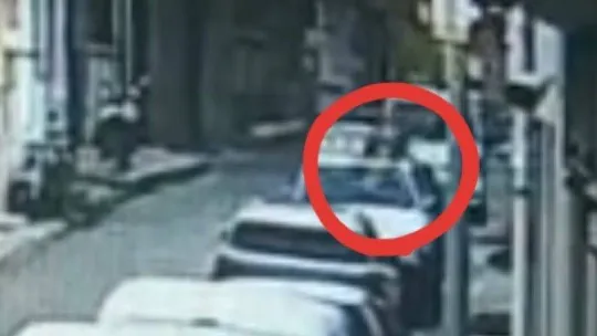 Pitbullu saldırıya uğradı...Kolları parçalandı, ölümden döndü