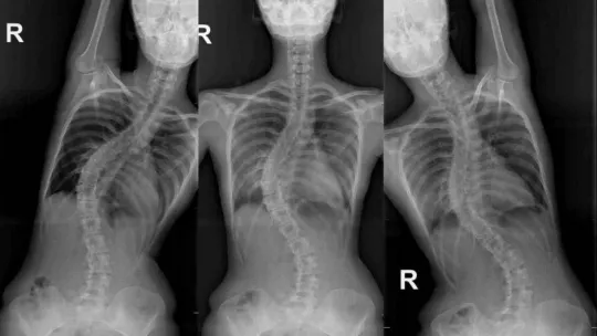 Rus kızın yüzü Türkiye'de güldü