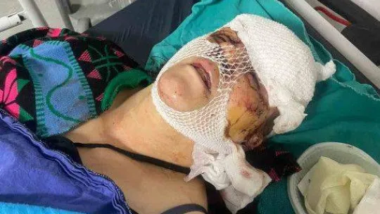 Sokak ortasında dehşeti yaşayan kadın: 'Ölmek istemiyorum'