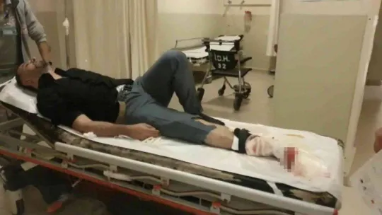 Sokak ortasında vuruldu