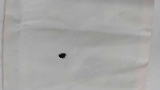 Tadilat yapacağım derken gözünden oluyordu