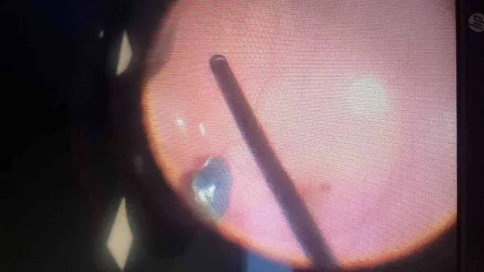 Tadilat yapacağım derken gözünden oluyordu