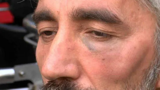 Tuzla'da gazeteciyi sokak ortasında darp ettiler