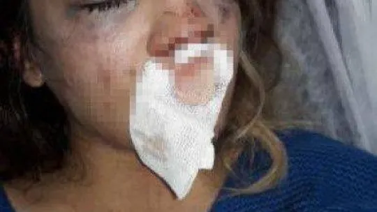 Üsküdar'da koca dehşeti: 4 aylık hamile karısını çocuğunun gözü önünde dövdü