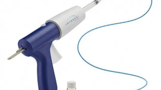 Venaseal yöntemi ile varislerden ameliyatsız kurtulmak mümkün