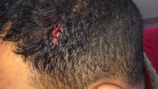 Yunan güvenlik güçlerinden düzensiz göçmenlere işkence