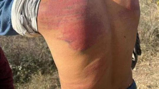 Yunan güvenlik güçlerinden düzensiz göçmenlere işkence