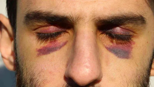 Yunan zulmü ile nehrin ortasında 16 gün mahsur kalan göçmenler Türk askeri tarafından kurtarıldı