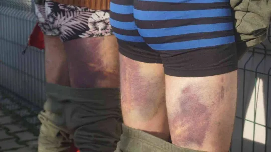 Yunan zulmü ile nehrin ortasında 16 gün mahsur kalan göçmenler Türk askeri tarafından kurtarıldı