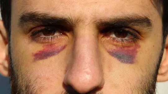 Yunan zulmü ile nehrin ortasında 16 gün mahsur kalan göçmenler Türk askeri tarafından kurtarıldı