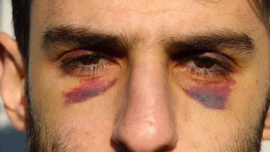 Yunan zulmü ile nehrin ortasında 16 gün mahsur kalan göçmenler Türk askeri tarafından kurtarıldı