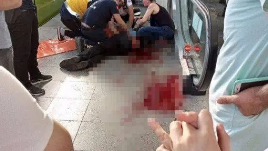 Yüzlerce kişinin gözü önünde yaşanan olayın sebebi dehşete düşürdü