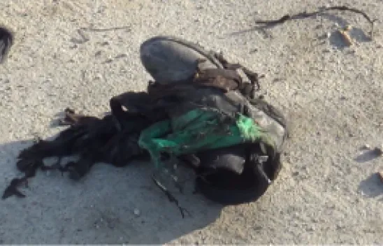 Isınmak istedi, feci şekilde yandı