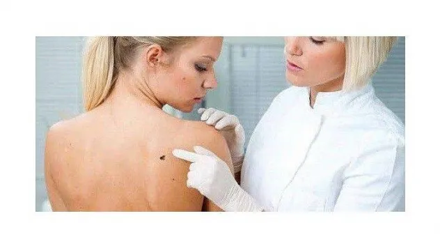 Sedef Hastalığı Teşhisi