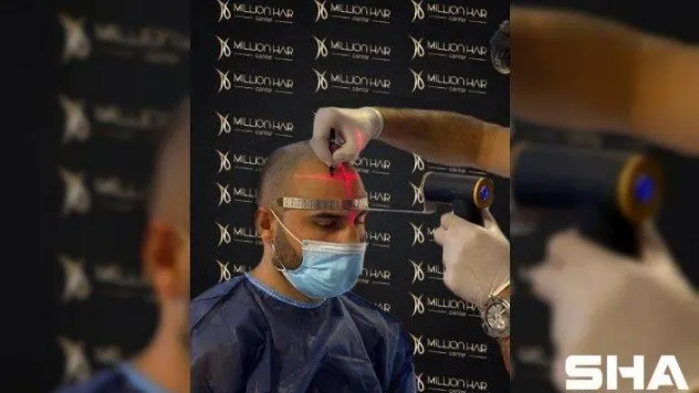 Million Hair Center CEO' su Fatih Köse: ''Saç ekiminin en önemli noktaları ön saç çizgisi ve doğal görünümdür''