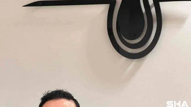 Bonita Hair Clinic, saç ekimi sonrası dikkat edilecekleri açıkladı