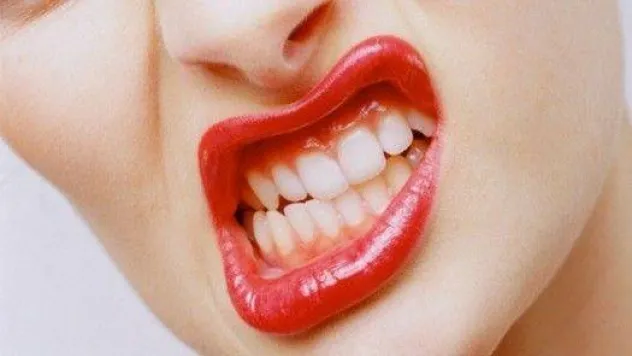 Diş Gıcırdatma Probleminiz Nasıl Son Bulur?