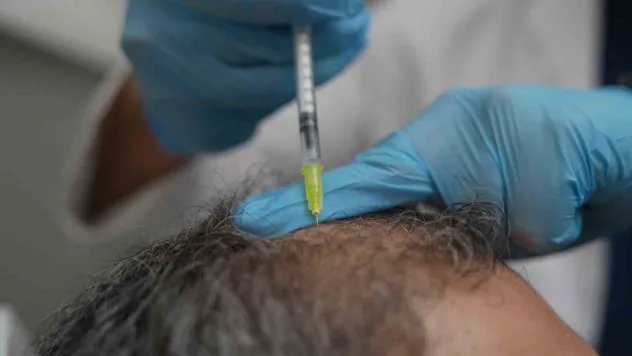 Dökülen saçlar vücudun bir alarmı olabilir