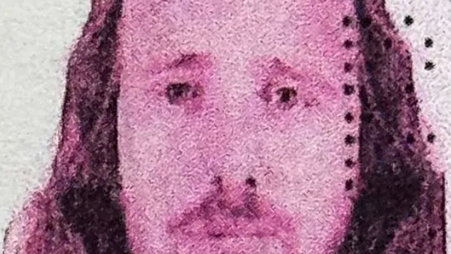 İngiliz vatandaşı, Türkiye'de saç ekimi ve diş tedavisi ardından hayatını kaybetti