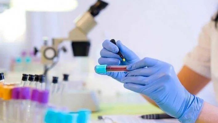 Evlenmeden önce mutlaka sağlık testi yaptırın!