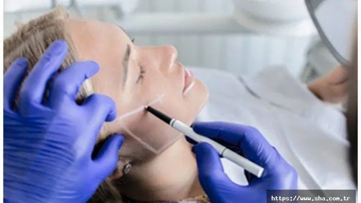 Merdiven altı estetik yüz anatomisini bozabilir