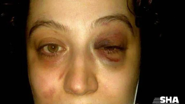Eski eşi tarafından tehdit ve darp edilen kadın suç duyurusunda bulundu