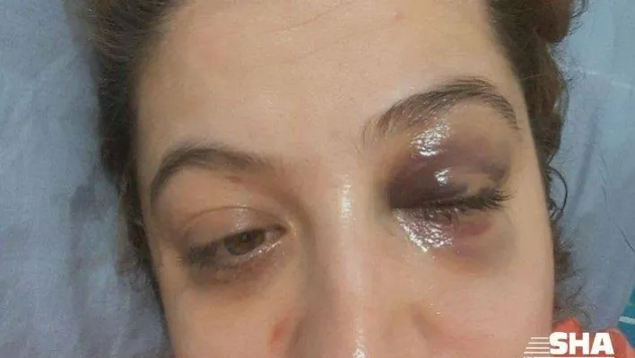 Eski eşini darp eden gözü dönmüş koca adliyeye sevk edildi