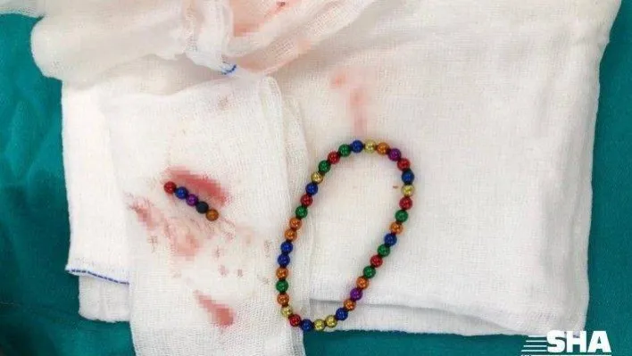 Karın ağrısıyla hastaneye giden çocuğun midesinden 42 adet mıknatıs topu çıktı