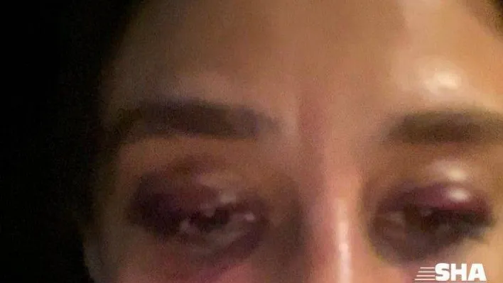 'Rubato Grubu'nun solisti sevgilisini darp etti' iddiası