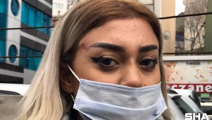 Dünyaca ünlü doktor yalanıyla kandırılan genç sağlıkçı, &quotYüzümdeki hasardan dolayı, 2 haftadır uyku uyuyamıyorum&quot