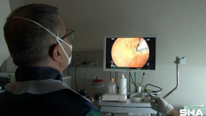 (ÖZEL) Başakşehir Şehir Hastanesi'nde ilk kez 3 yaşındaki çocuğa 'ERCP' tedavisiyle uygulandı