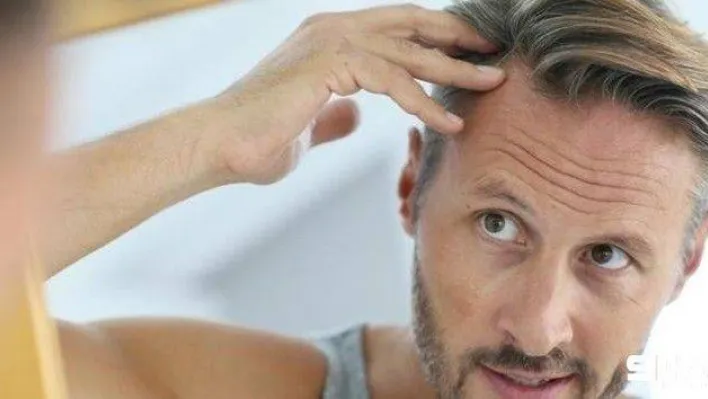 Uzmanından saç ekimine dair 6 maddede doğru bilinen yanlışlar