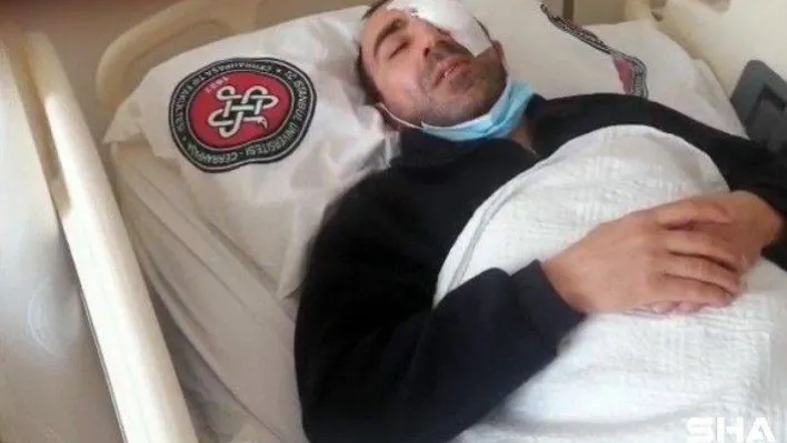 Avcılar'da trafik magandaları kameramanın gözünü kör etti