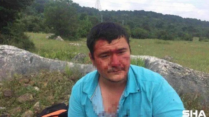 Lütfü Türkkan'ın adamlarının darp ettiği muhabirin yüzündeki iz bir ömür kalacak