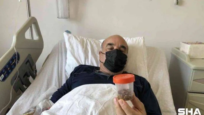 Sırtında açılan 1 santimetrelik delikten bin 200 taş çıkartıldı