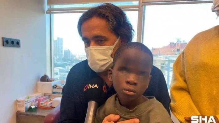 Üvey annesi tarafından asitle gözü yakılan çocuk, tedavi için Türkiye'ye getirildi
