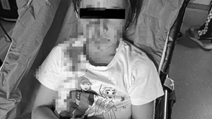 Esenyurt'ta başıboş köpek dehşeti: Site bahçesinde oynayan kıza saldırdı