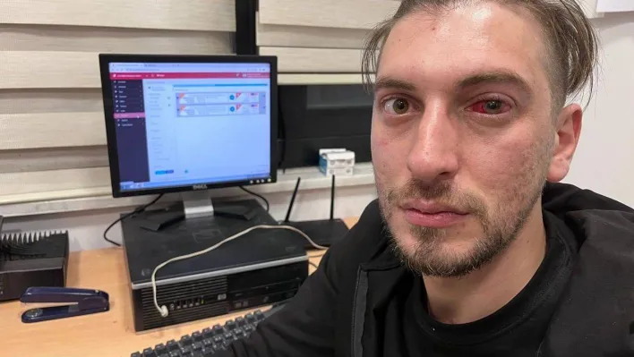 Esenyurt'ta sağlık çalışanlarına demir sopalı saldırı