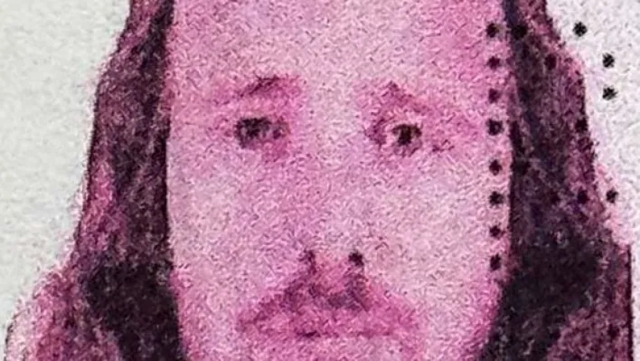 İngiliz vatandaşı, Türkiye'de saç ekimi ve diş tedavisi ardından hayatını kaybetti