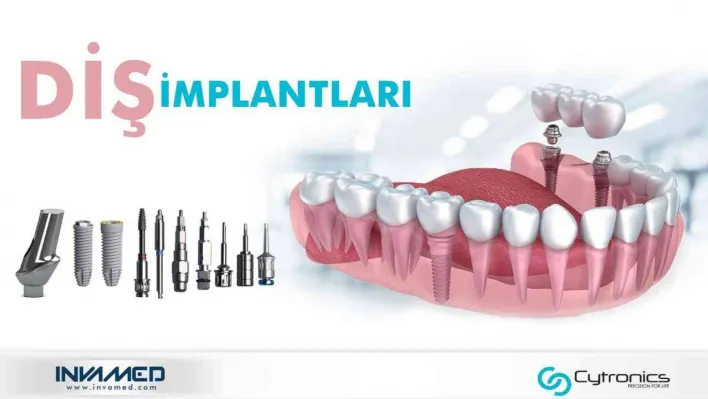 INVAMED'in ürettiği diş implantları birçok ülkeye ihraç ediliyor