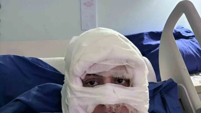 Kadıköy'de akıl almaz olay: Genç kadın başka bir kadın tarafından ateşe verildi