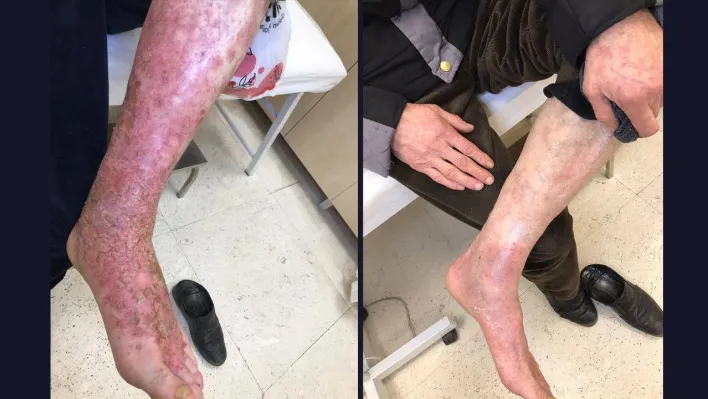 Kolan hastanesi şifa dağıtmaya devam ediyor