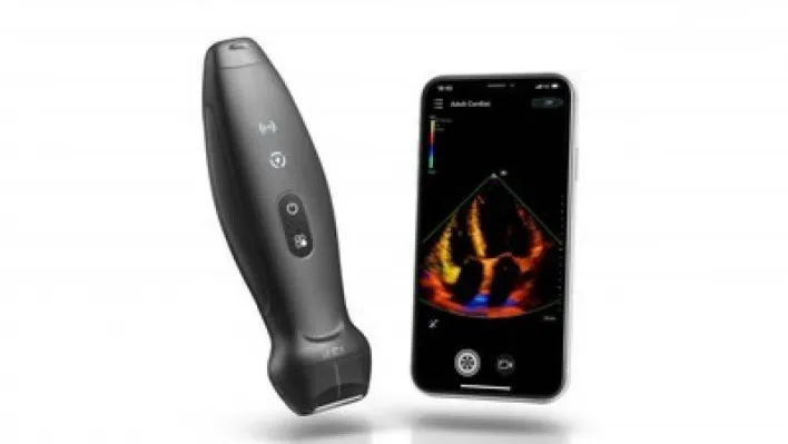 Mindray, kablosuz elde taşınabilir ultrason sistemini tanıttı