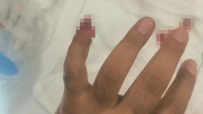 Uyuşturucuyla yakalanan şüpheli, polisin parmağını kopardı