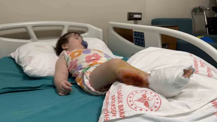 Üzerine çaydanlık devrilen 1 yaşındaki bebek dehşeti yaşadı, vücudunun yüzde 15'i yandı
